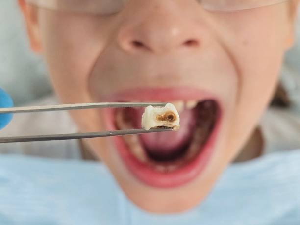 Best Emergency TMJ Treatment in Otterbe, IN