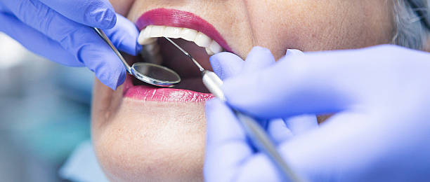 Best Emergency Root Canal Treatment in Otterbe, IN